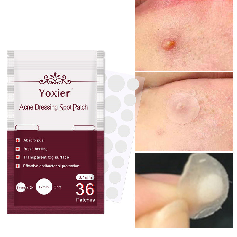 Hydrocolloid acne patches for blemish treatment
